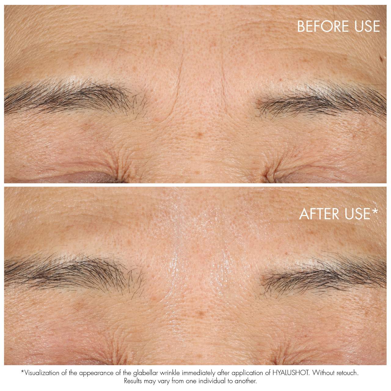 Totale Hyalushot- Wrinkle Corrector with Hyaluronic Acid2