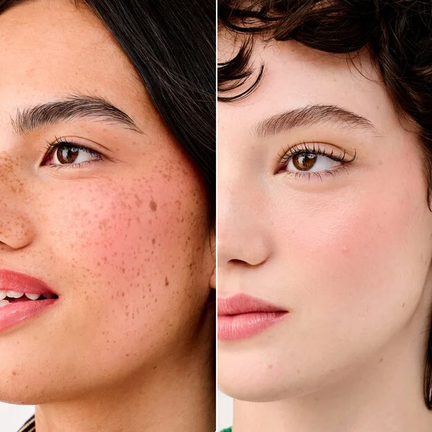 Before_and_After_CheekScore