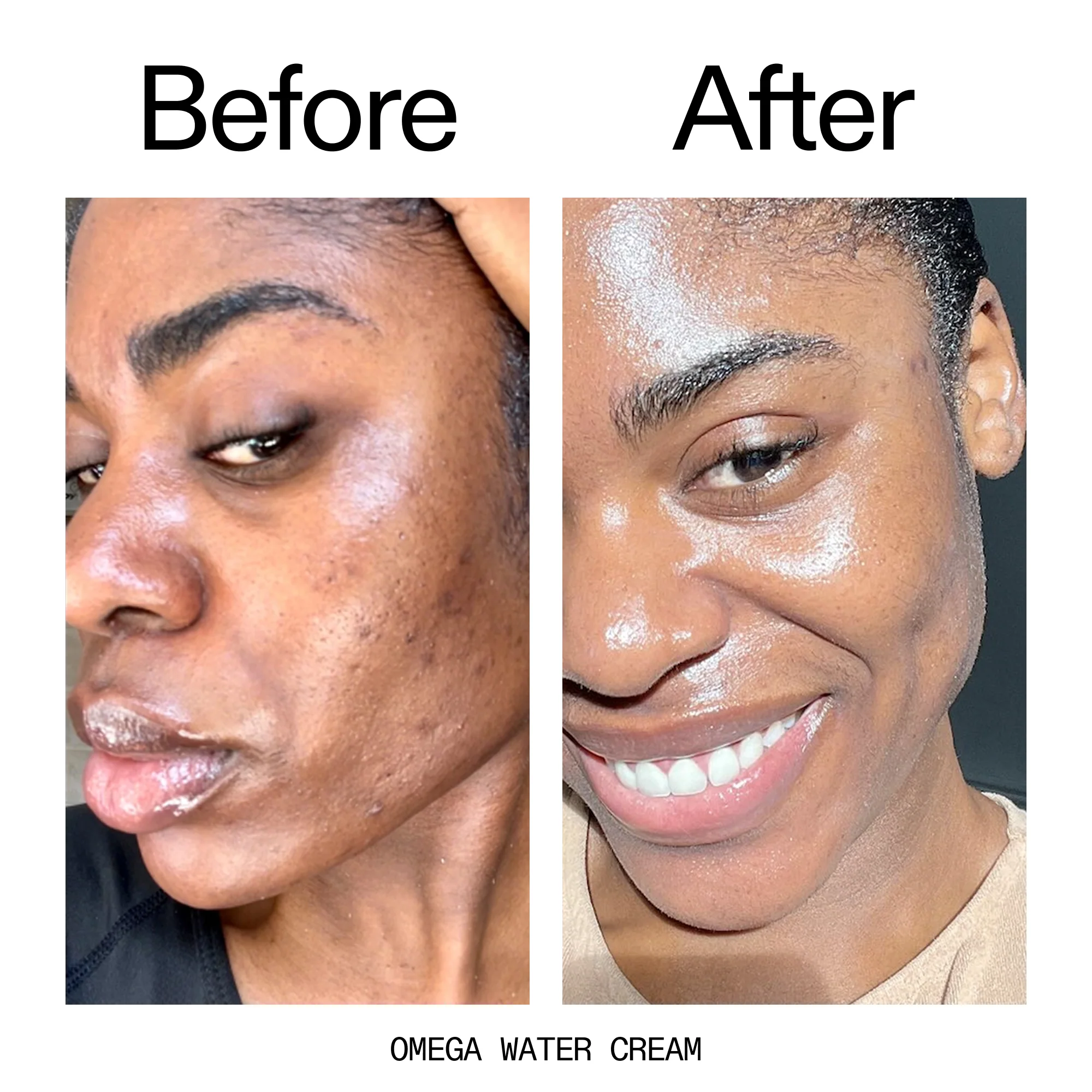 Omega_Water_Cream_Before_After_2000x2000_8e88278b-8c8d-48dc-ac77-4e98ebbd1b77_2150x_crop_center