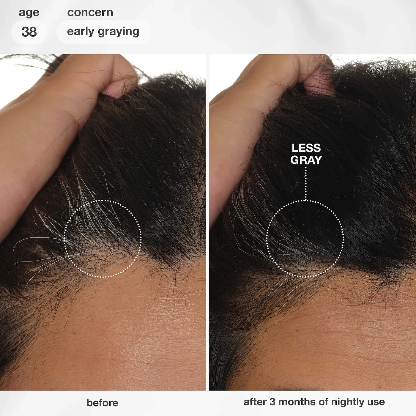 s2994127-av-4-zoom (1)